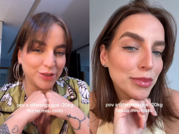 Bruna Unzueta choca seguidores com antes e depois do rosto após emagrecer 20 kg