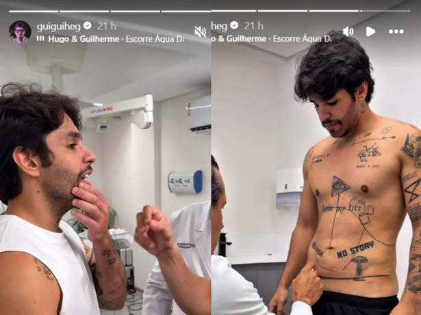Cantor Guilherme corrige preenchimento de barba e faz procedimento para barriga flácida