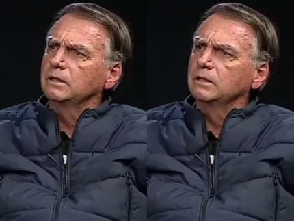 Carcinoma de células escamosas: especialista explica câncer diagnosticado em Bolsonaro