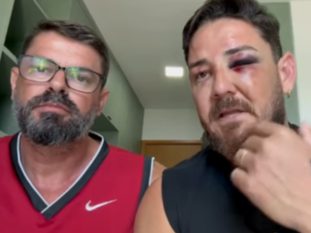 Casal de turistas espancados em Porto de Galinhas vai processar município e estado