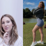 Médica explica cirurgia de lipedema feita na ex-BBB Amanda Meirelles: “preventiva”