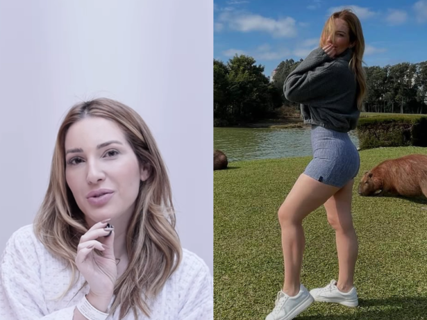 Médica explica cirurgia de lipedema feita na ex-BBB Amanda Meirelles: “preventiva”