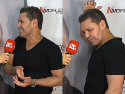 Eduardo Costa revela pré-depressão e queda de cabelo, e detalha implante capilar
