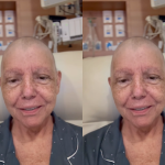 Roseana Sarney recebe alta após tratar pneumonia e segue recuperação em casa