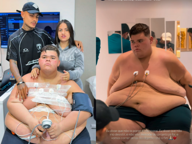 Gordão da XJ passa por exames pré-operatório para retirada de pedra na vesícula após perder 130 kg