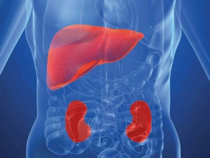 Hiperoxalúria Primária Tipo 1 (HP1): o que é a doença ultrarrara que afeta rins e fígado