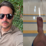 Kaká Diniz detalha recuperação após grave lesão no tornozelo: “Um mês e meio sem pisar”