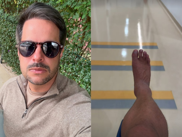 Kaká Diniz detalha recuperação após grave lesão no tornozelo: “Um mês e meio sem pisar”