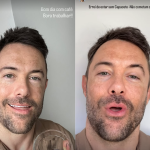 Kayky Brito leva pontos na cabeça após novo acidente e faz alerta nas redes sociais