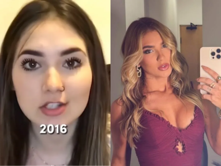 Antes e depois da fama: veja como visual dos artistas mudou após o sucesso 1 foto leo dias 2025 10 23T032220.532