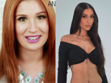 Antes e depois da fama: veja como visual dos artistas mudou após o sucesso 5 foto leo dias 2025 10 23T032653.695