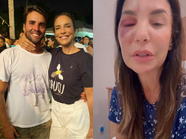 Ex-marido de Ivete Sangalo, Daniel Cady atualiza quadro de saúde da cantora: “Mulher de aço”