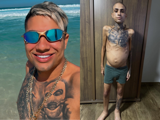 Influenciador Jota Surfista, que lutava contra câncer e cirrose, morre aos 30 anos