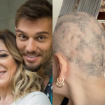 Mãe de Lucas Lucco desabafa sobre alopecia: “Mesmo raspando, as falhas ainda ficam visíveis”