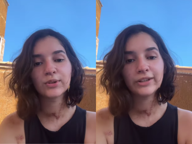 Após ser esfaqueada 15 vezes, vítima de tentativa de feminicídio se pronuncia
