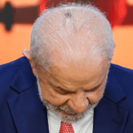 Lula passa por consulta médica após retirada de lesão na cabeça