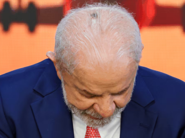Lula passa por consulta médica após retirada de lesão na cabeça