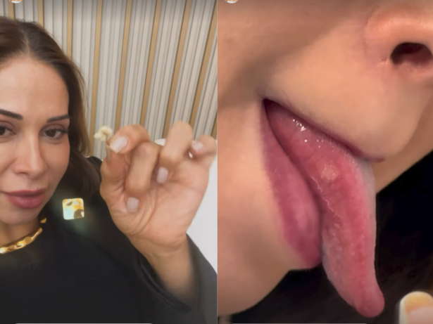 Com dente caído e língua ferida, Maíra Cardi relata desafios de cuidar de Thiago Nigro após cirurgia