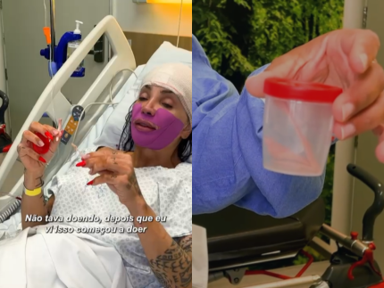 Maya Massafera faz cirurgia e retira parte do maxilar para deixar rosto “mais delicado”