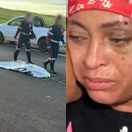 Mulher dada como morta por médica do Samu após atropelamento em SP recebe alta