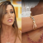 Mulher atacada por tubarão em Fernando de Noronha relembra o momento do incidente