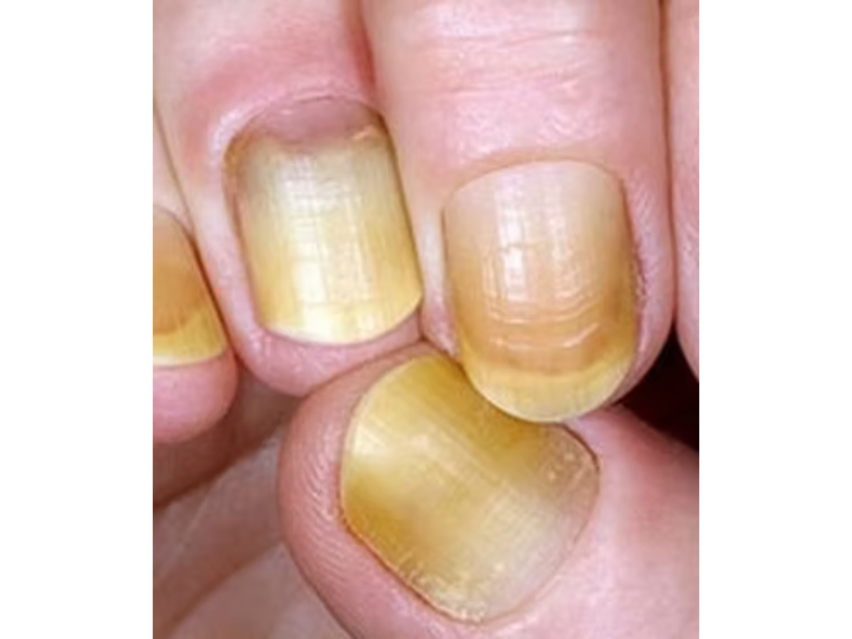 Reprodução drdanilodermatologia.com.br Reprodução drdanilodermatologia.com.br