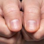 Unhas com meia-lua