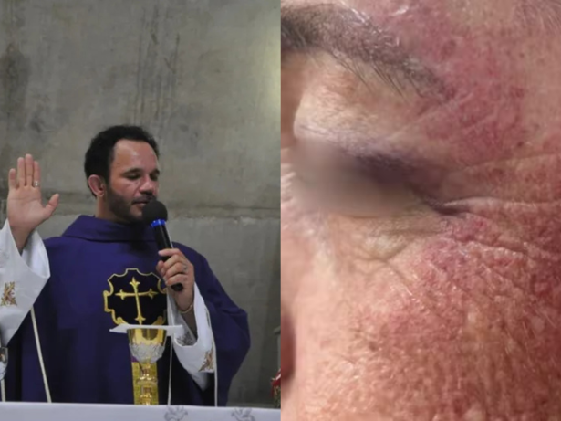 Padre responde por lesão corporal por supostamente agredir idosa em exorcismo em SP
