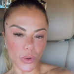 Poliana Rocha é diagnosticada com conjuntivite química: “Não é contagiosa”
