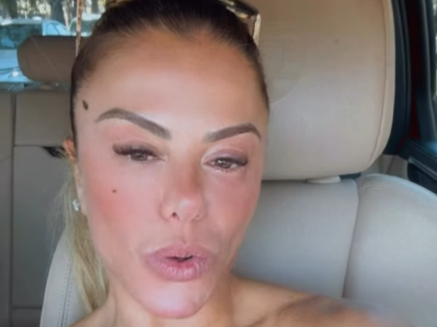Poliana Rocha é diagnosticada com conjuntivite química: “Não é contagiosa”