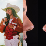 Yasmin Santos fala sobre rinoplastia e explica por que fez cirurgia no nariz