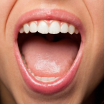 Conheça a HPP, doença rara que afeta ossos e dentes e pode levar décadas para diagnóstico