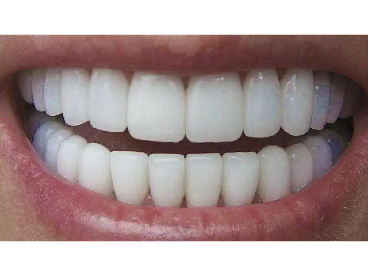 Reprodução dentistatatuape.com