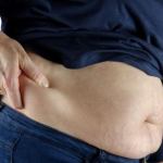 Síndrome metabólica: 4 fatos que você precisa saber sobre gordura abdominal