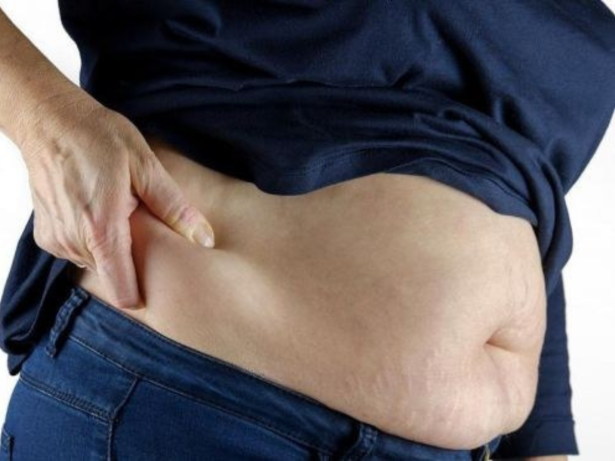 Síndrome metabólica: 4 fatos que você precisa saber sobre gordura abdominal