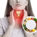 Tireoide e alimentação: o que pode e o que deve ser evitado
