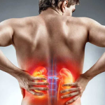 Uso de anti-inflamatórios sem orientação pode agravar doenças renais, alerta especialista
