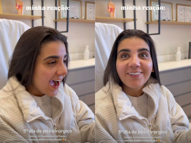 Yasmin Santos reage ao ver resultado de cirurgia plástica no nariz: “Sou outra pessoa”