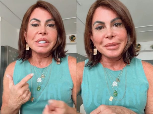 Gretchen desabafa sobre alopecia e revela real causa da queda de cabelo