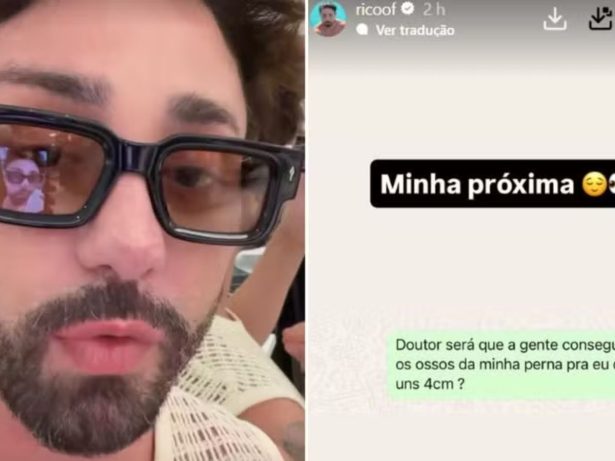 Rico Melquiades cogita cirurgia para diminuir a altura: “Serrar os ossos da perna”