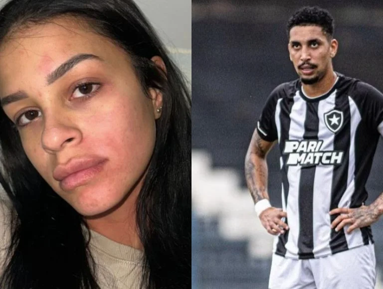 Jogador do Botafogo é acusado de agressão por ex-namorada