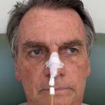 Exames indicam evolução no quadro clínico de Jair Bolsonaro após cirurgia intestinal
