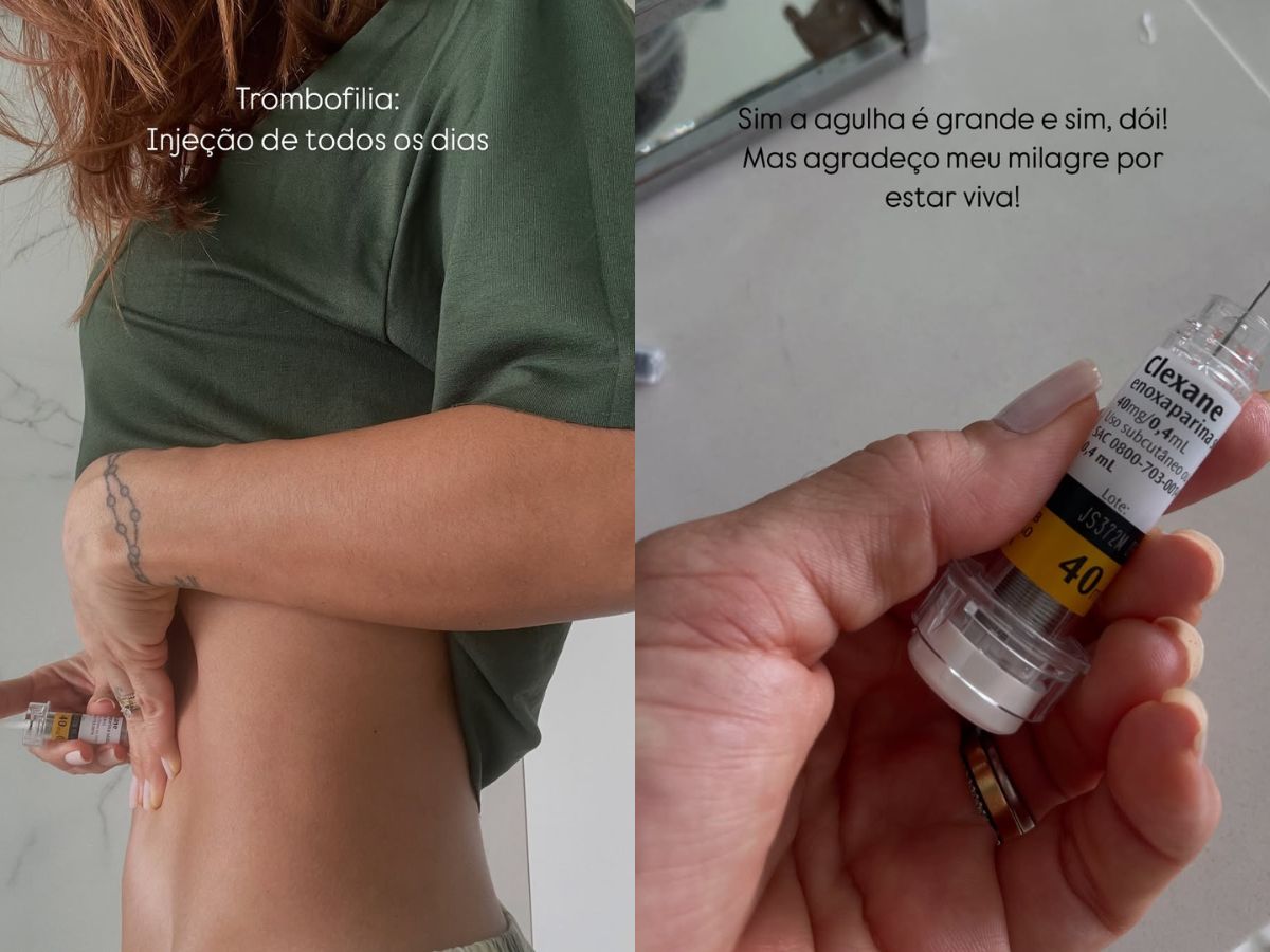 Reprodução 