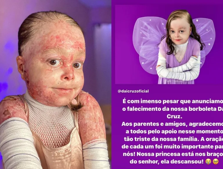 Morre aos 31 anos,  influencer Dai Cruz,  portadora de doença rara