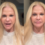 Monique Evans comemora resultado de cirurgia facial: “Chocada com a minha cara”