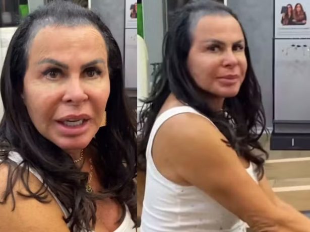 “Não tenho mais cabelo”: Gretchen desabafa sobre queda capilar