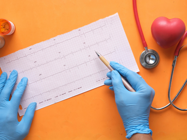 Novas diretrizes reduzem limite do “colesterol ruim” para prevenir infartos e AVCs
