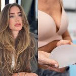 Contratura capsular: Entenda complicação no silicone que afetou Xuxa e Romana Novais