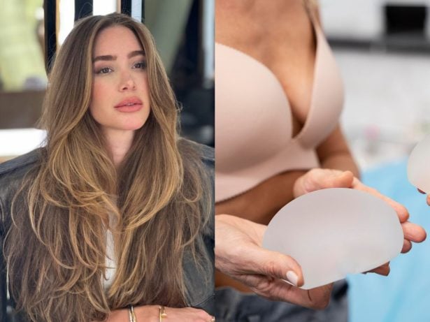 Contratura capsular: Entenda complicação no silicone que afetou Xuxa e Romana Novais