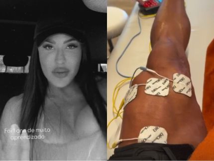 Gracyanne Barbosa celebra melhora no joelho após um ano de cirurgia
